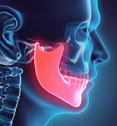 Image of a human jaw at Glen Perio in Glenview, IL.